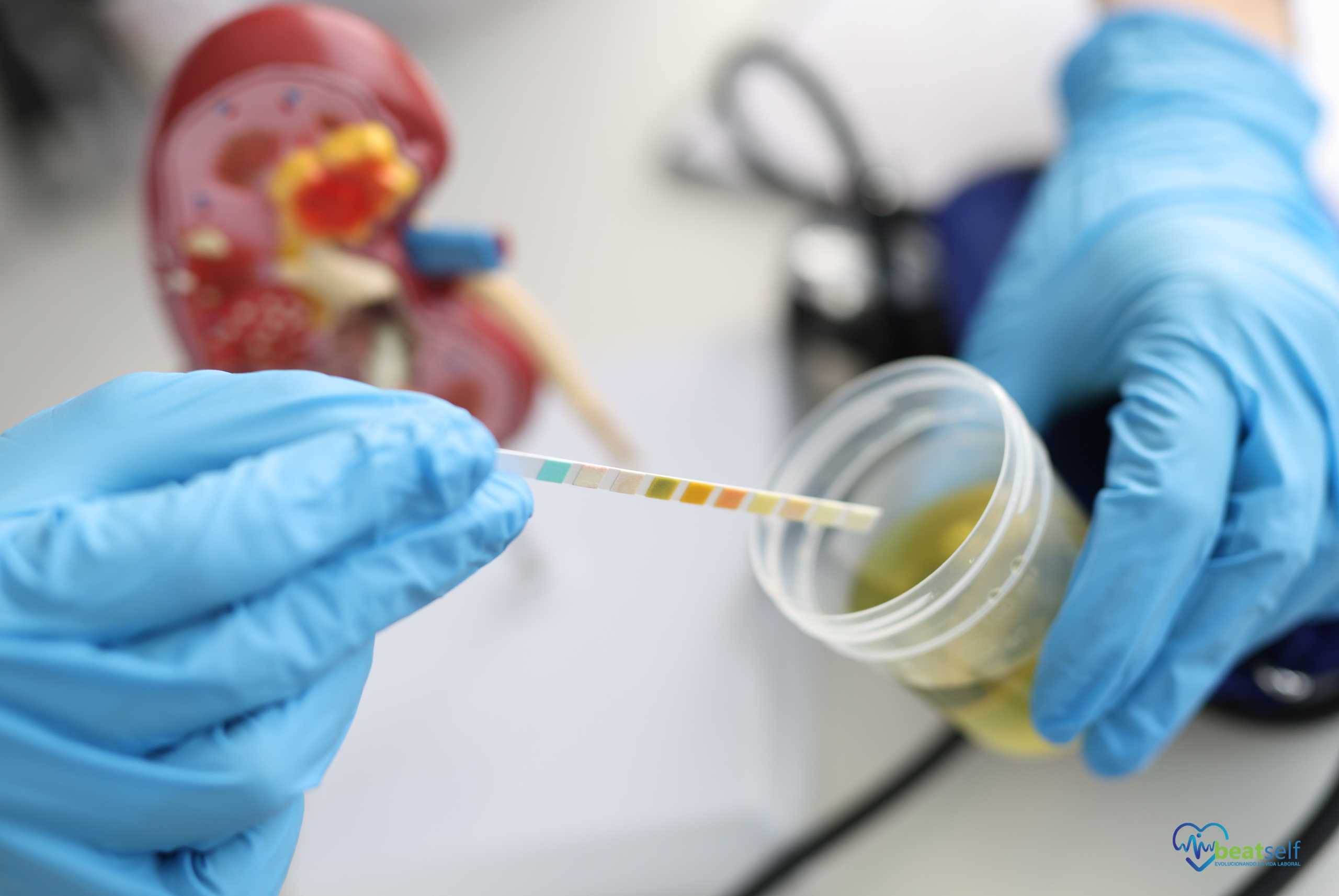 Test de drogas de orina: toma de muestras confiables en Beatself